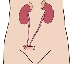Urostomia