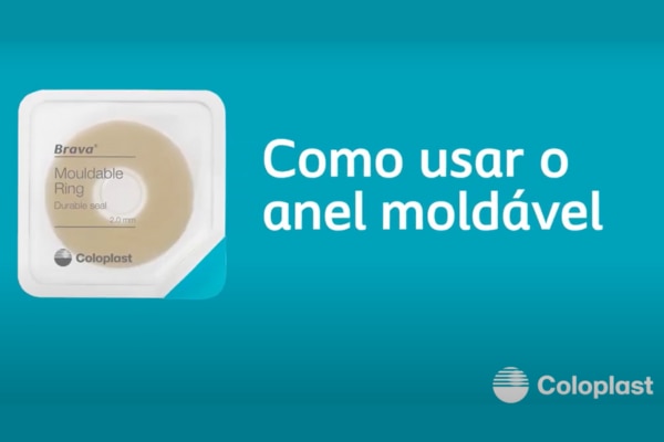 Anel Moldável - Como realizar aplicação de forma adequada.