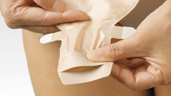 Trocando sua bolsa de ileostomia